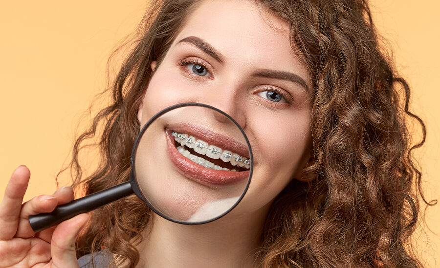 braces