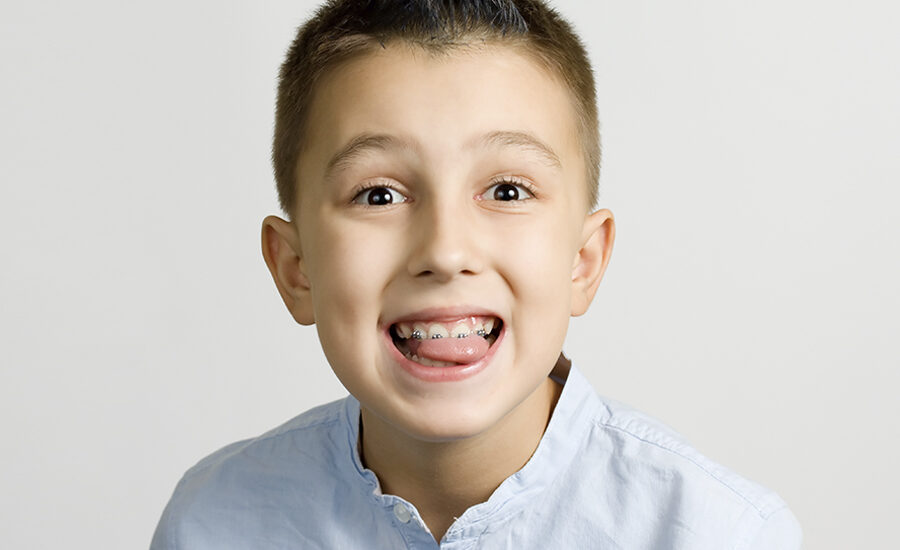 braces