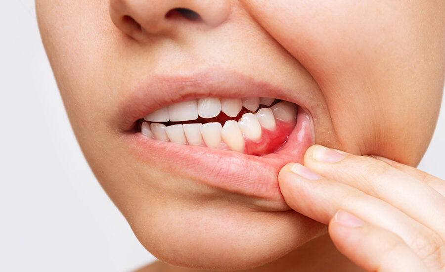Woman portrait feeling tooth pain at home