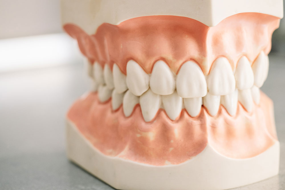 dientes mueven moreda 2